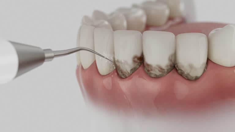 Trusted Emergency Dentist service in Gramercy, LA - Dentist Open Now